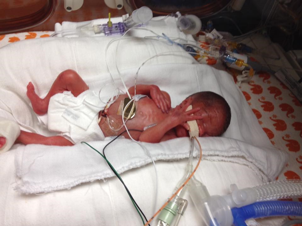 Laila weighted 22 ounces at birth